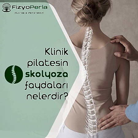 Skolyoz nedir? Klinik pilatesin skolyoza faydaları nelerdir?